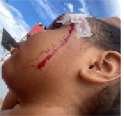 Mãe é presa acusada de atirar cabo de vassoura e causar corte profundo na cabeça da filha de 3 anos