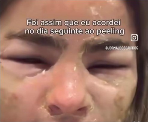 Médica tem rosto desfigurado por procedimento estético feito por dentista; veja vídeo