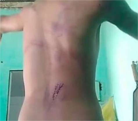 Menino de 13 anos é brutalmente agredido pelo pai em Cuiabá