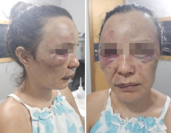 Mãe de adolescente jogada em poço teve rosto desfigurado durante espancamento