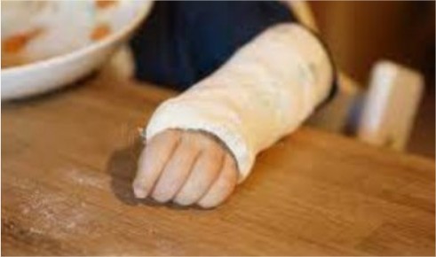 Mãe é presa acusada de torturar filho com pancadas, queimadura de cigarro e mordidas em MT