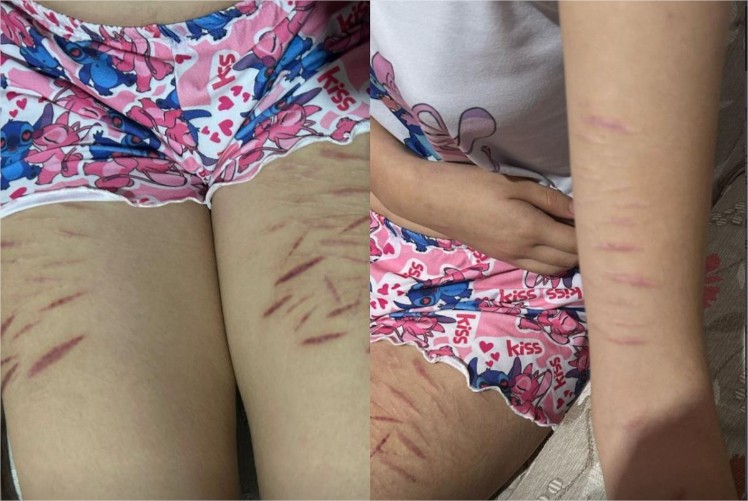 Garoto de 15 anos fazia vítimas beberem água da privada e se cortarem