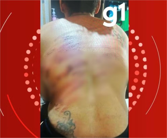 Jovem sequestrada é resgatada pela 2ª vez após ser torturada com 50 chibatadas em MT