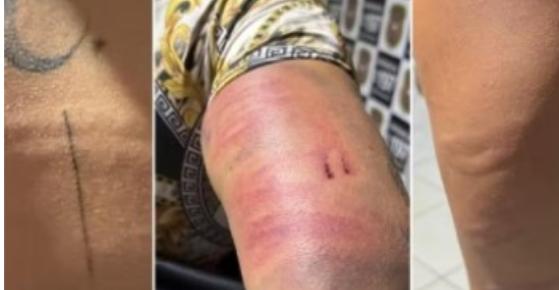 Facção ordena agressão a garotas de programa em MT