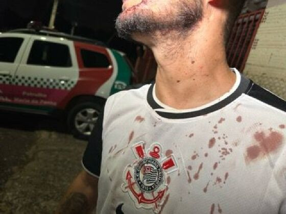 Torcedor ataca vizinho com facão após derrota do Flamengo