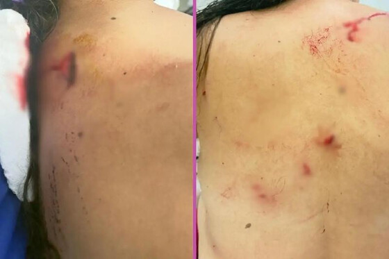 Mulher é esfaqueada 15 vezes depois de ser atraída para emboscada por ex