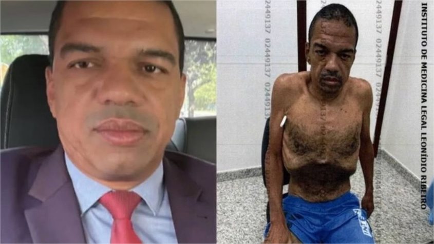 Em estado esquelético, lobista deixa cadeia e cumpre prisão domiciliar por risco de morte
