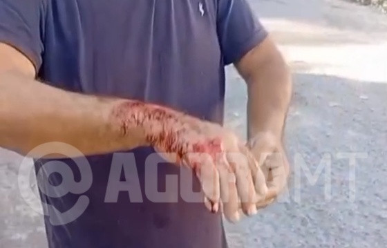 Pitbull descontrolada escapa de imóvel, mata outro pet e ataca vizinho