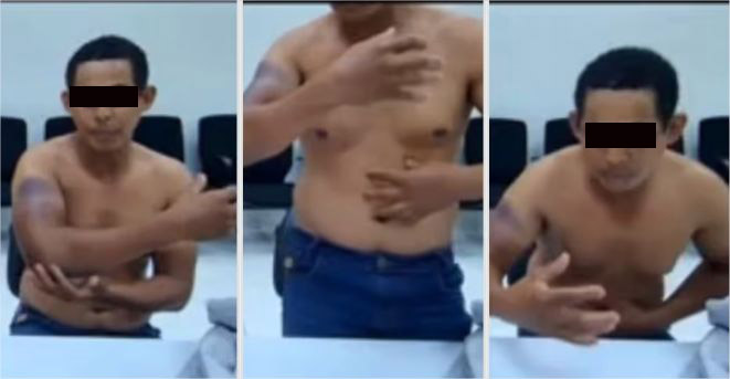 Bandido preso por assalto a banco em MT alega ter sido torturado por policiais da GCCO