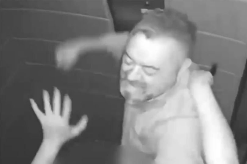 Veja vídeo e fotos de lesões em mulher espancada por empresário em elevador