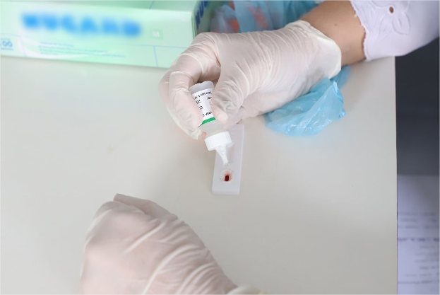 Paciente de SP fica 17 meses curado do HIV com tratamento experimental