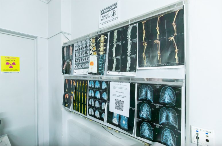 Saúde de Cuiabá já oferece mamografia e ressonância para mulheres