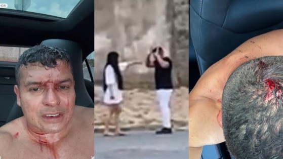 Waltinho Produções se apresenta em delegacia e afirma que foi agredido por ex; Veja vídeos