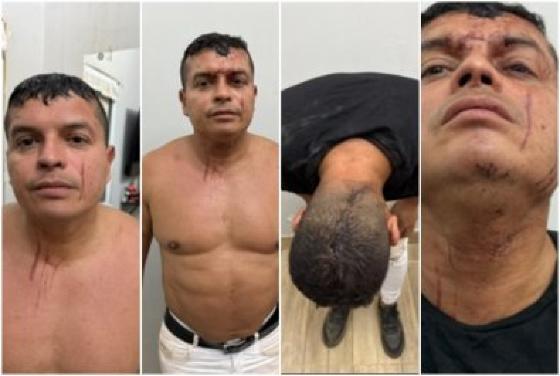 ‘Fui atacado’, diz policial acusado de espancar ex em Cuiabá