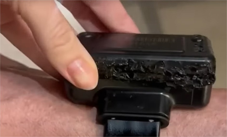 Bolsonaro diz à PF que tentou abrir a tornozeleira com ferro quente; vídeo