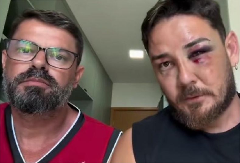 Turistas de MT são espancados em Porto de Galinhas após discussão por preço de cadeiras