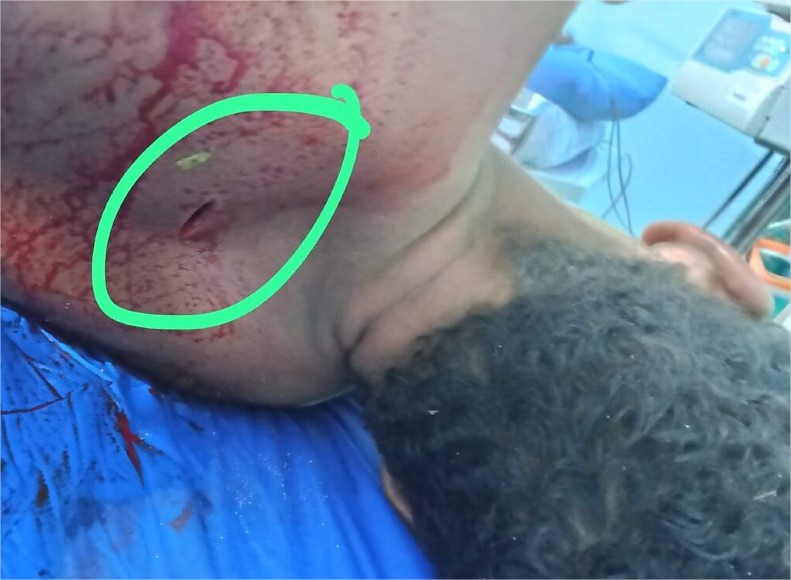 Homem que teria estuprado mulher em construção é espancado