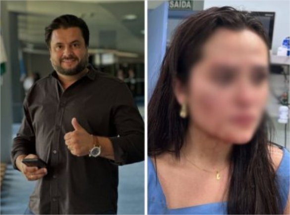 Justiça não vê periculosidade e solta secretário que espancou esposa em MT