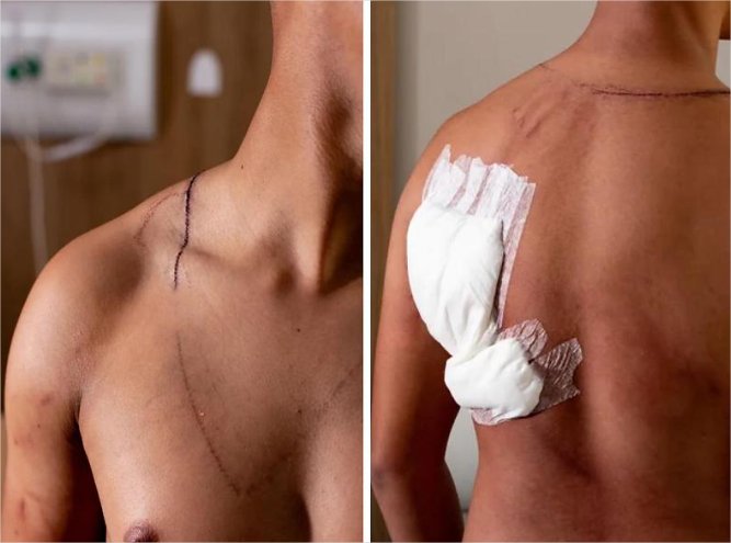 Jovem atingido por raio em ato em Brasília recebe alta após três dias internado