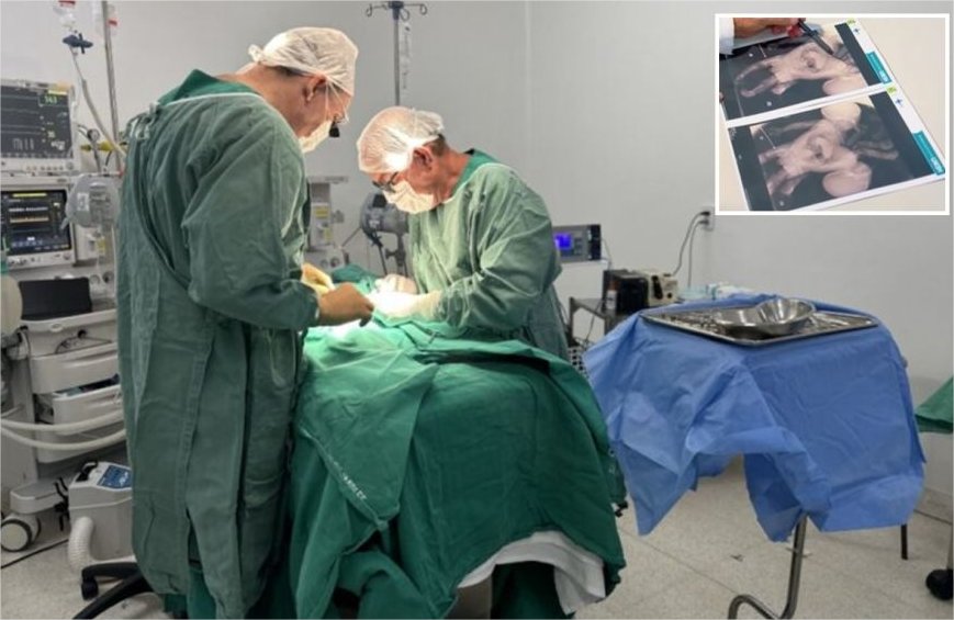 Gêmeos siameses de MT morrem após cirurgia em Goiânia