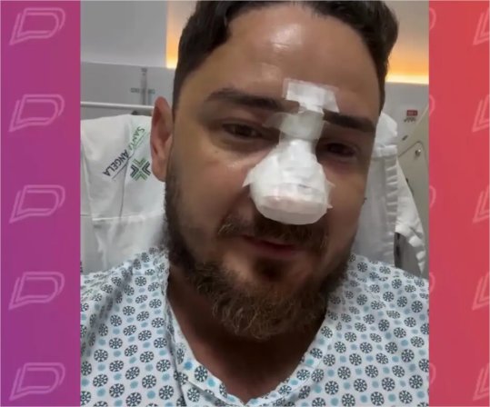 Turista de MT passa por cirurgia após fraturas no rosto causada por agressão em Porto de Galinhas