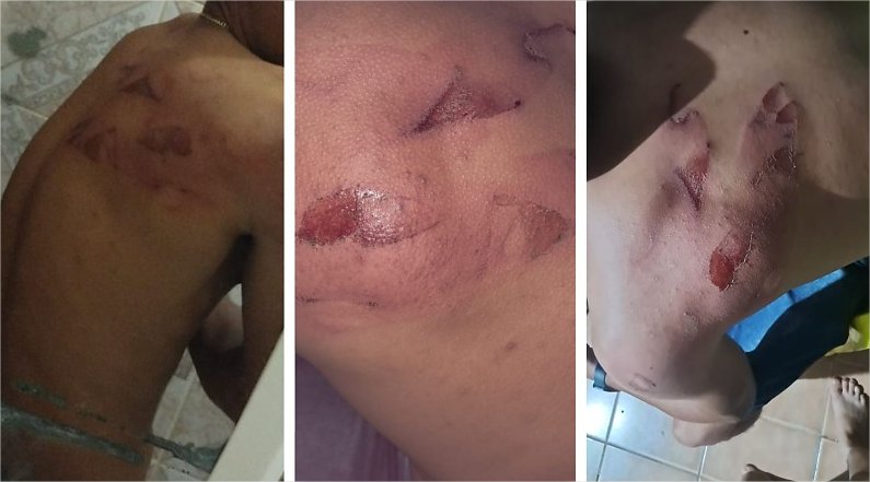 Trabalhadores denunciam que foram espancados com facão por patrões armados em alojamento