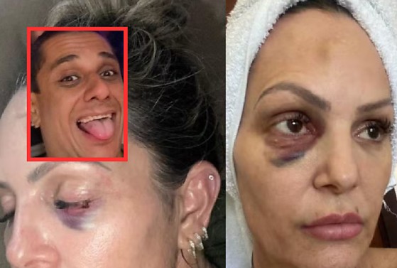 Juíza manda colocar tornozeleira eletrônica em policial que espancou personal em Cuiabá