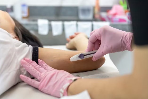 Veja onde aplicar chip anticoncepcional gratuito pelo SUS em Cuiabá