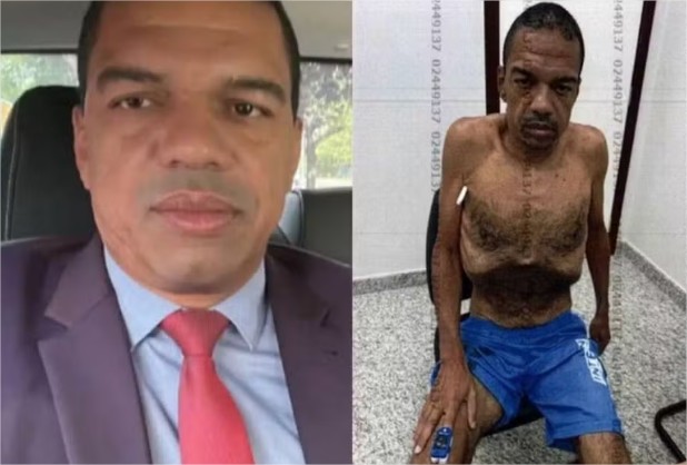 STF vê tentativa de simular doença e mantém prisão de lobista que ficou esquelético em presídio
