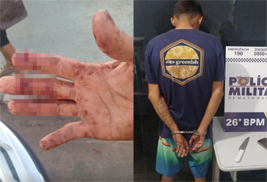 Homem tem os dedos cortados ao defender amiga de roubo em MT