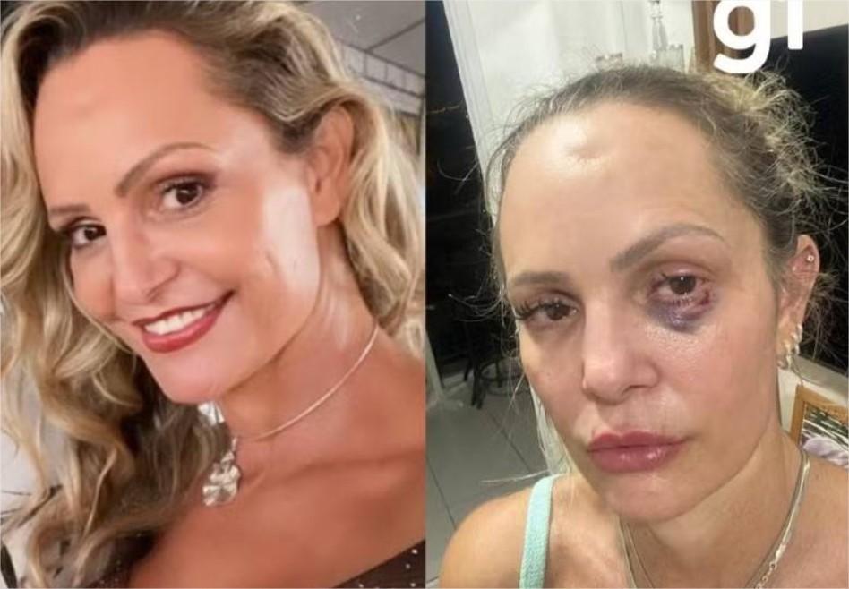 TJMT anula condenação por estupro contra ex-mulher e reduz pena de policial civil para regime aberto