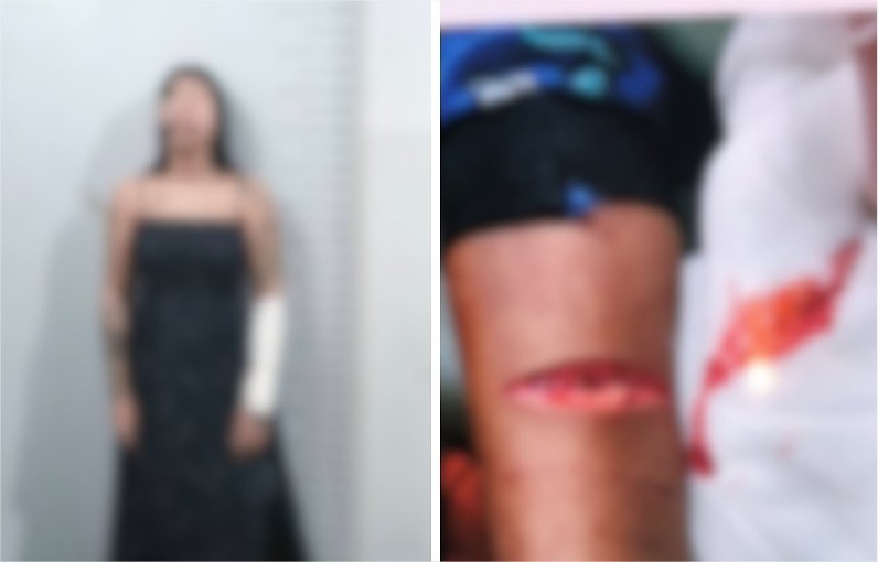 Mulher é presa em Cuiabá após ferir filho com navalha e tentar suicídio