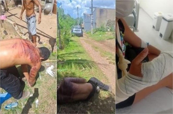 Homem decepa dedos da ex, foge e acaba espancado por facção em Cuiabá